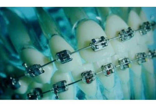 Анализ Мягких Тканей При Ортодонтическом Лечении