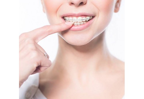 КАК ПРАВИЛЬНО СНЯТЬ БРЕКЕТЫ